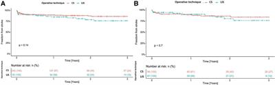 Stroke and pump thrombosis following left ventricular assist device implantation: The impact of the implantation technique